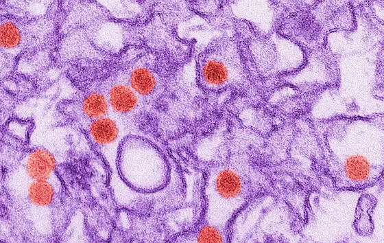 What Can CRISPR Do to Help in the Fight Against Zika Virus?