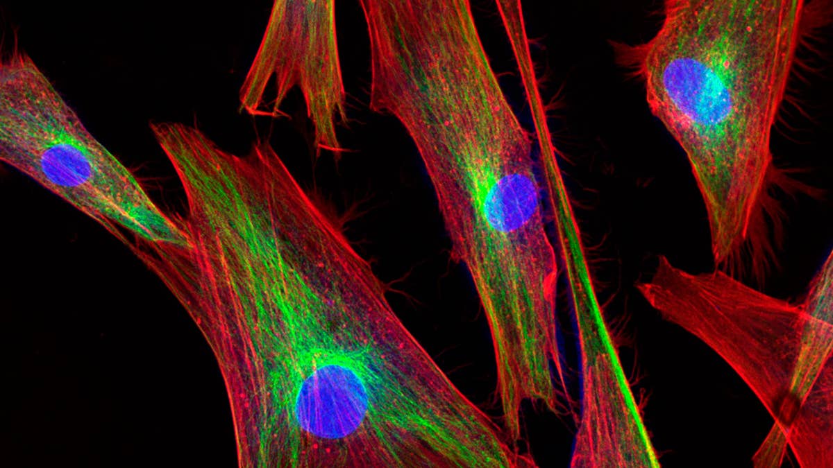 Confocal microscopy image of fibroblast cells
